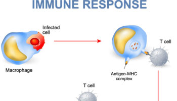 immune response