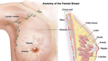 intraductal papilloma