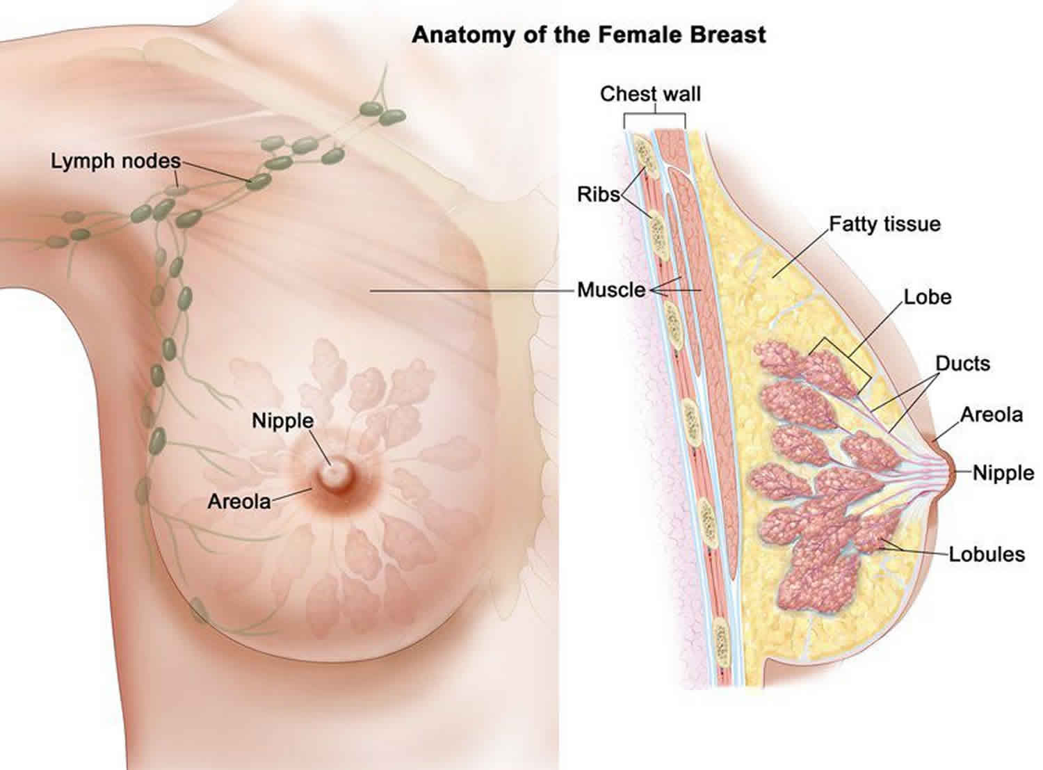 papilloma benign breast tumor