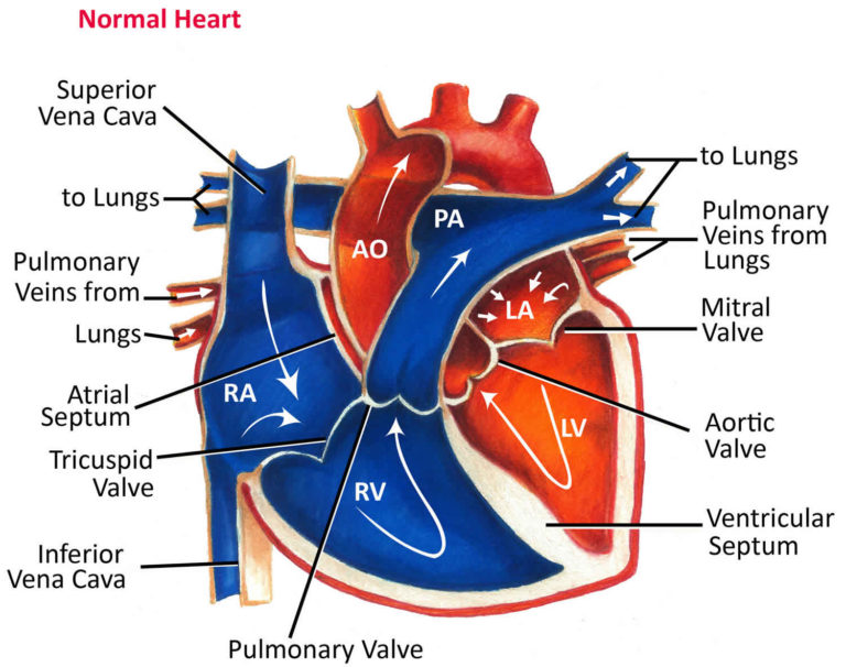 Truncus arteriosus causes, symptoms, diagnosis, treatment & prognosis