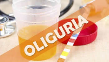 oliguria