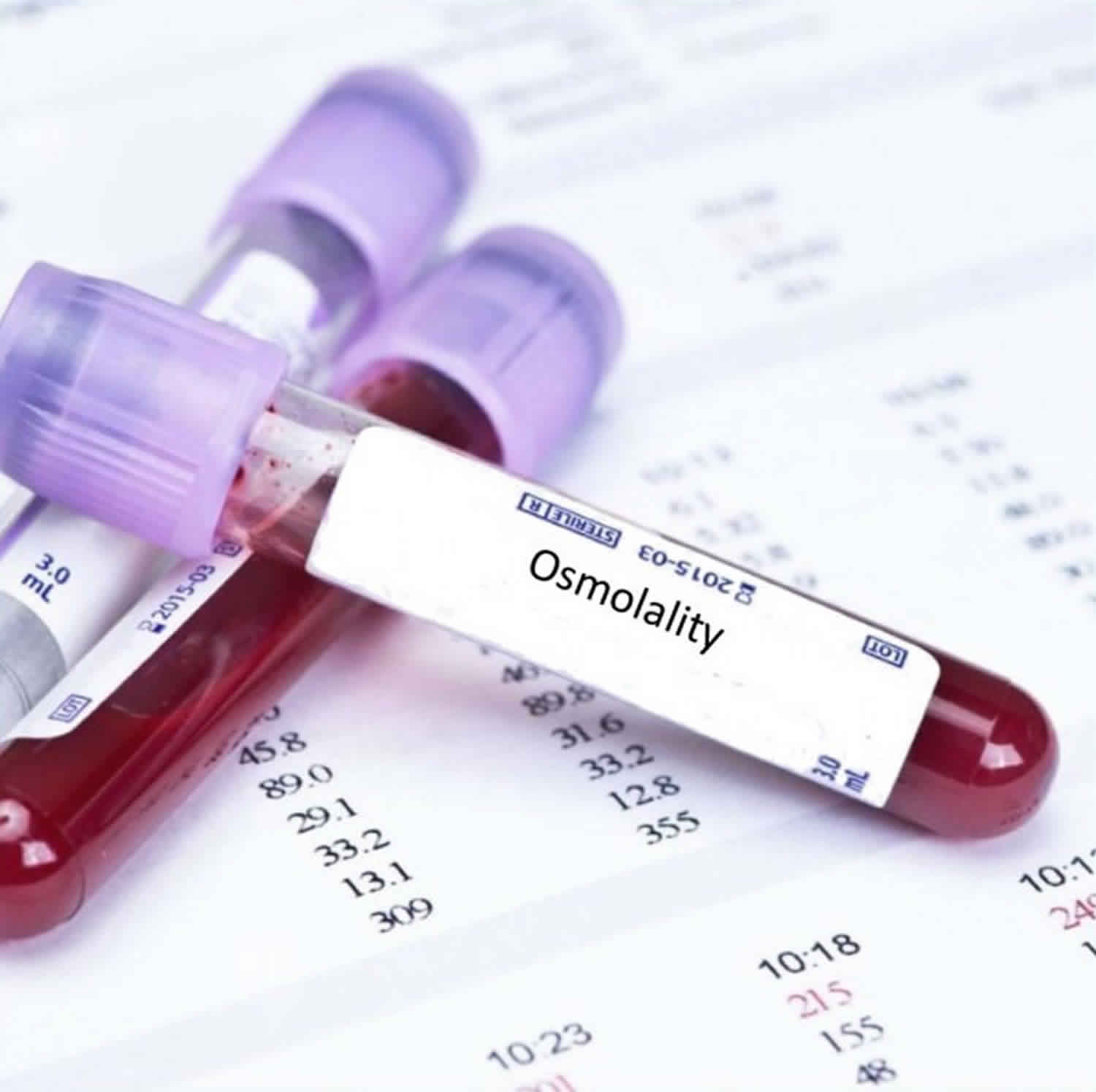 Osmolality Serum Osmolality Urine Osmolality Normal Range Equation