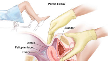 pelvic exam