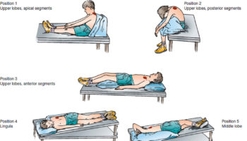 postural drainage