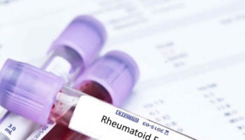 rheumatoid factor