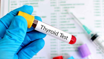 thyroid blood test