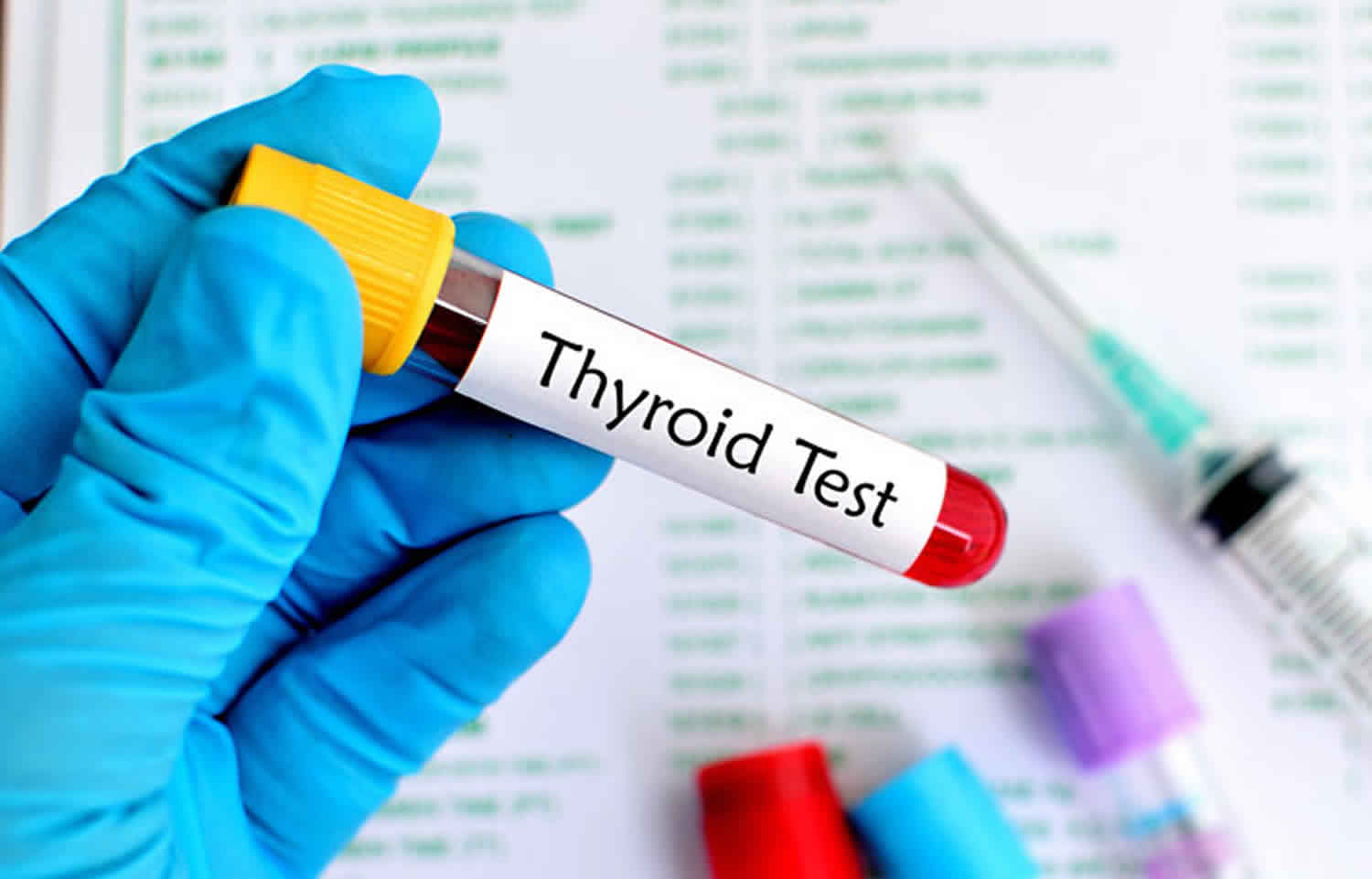 Thyroid blood test, thyroid function test, normal values & results ...