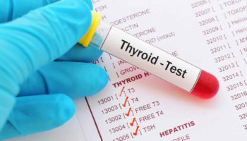 thyroid peroxidase antibody