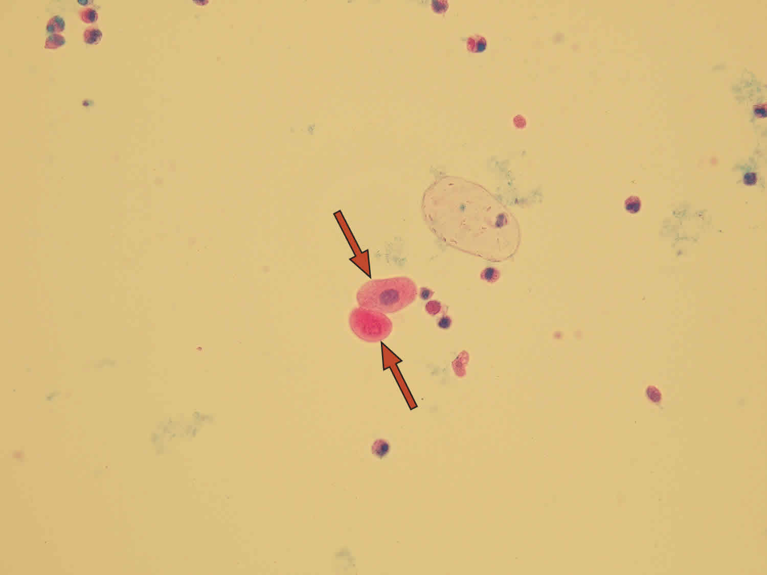 Epithelial Cells In Urine What Does It Mean If You Have Epithelial Cells In Urine 4949