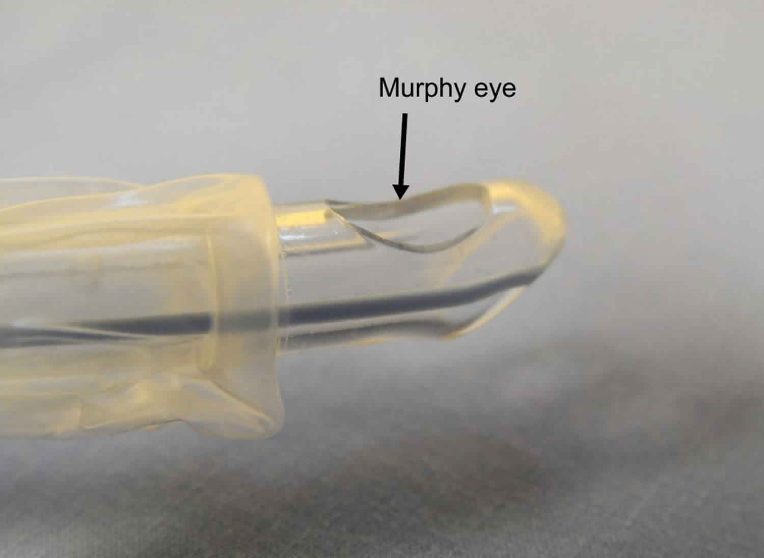 Murphy eye of an endotracheal tube