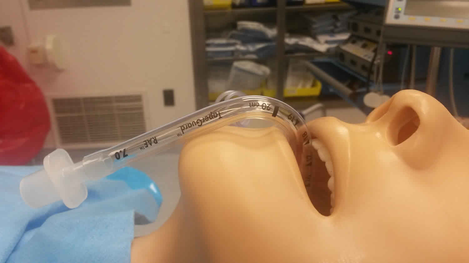 Oral endotracheal tube in position