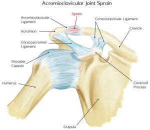 Acromioclavicular joint, acromioclavicular joint injury, separation ...