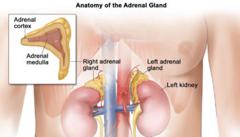 adrenal adenoma