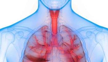 alpha 1 antitrypsin deficiency