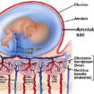 amniotic sac