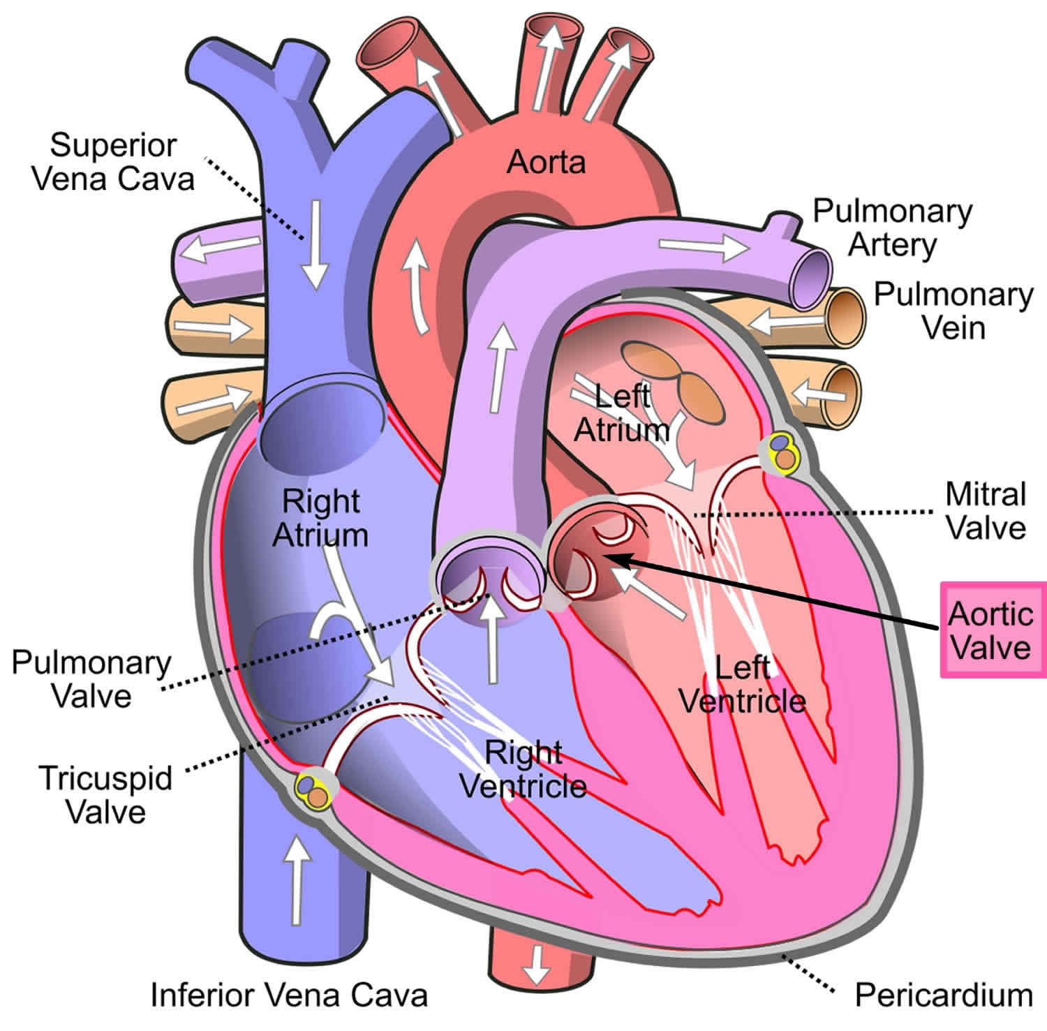 Aortic stenosis causes, symptoms, diagnosis, treatment & surgery