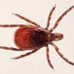babesiosis