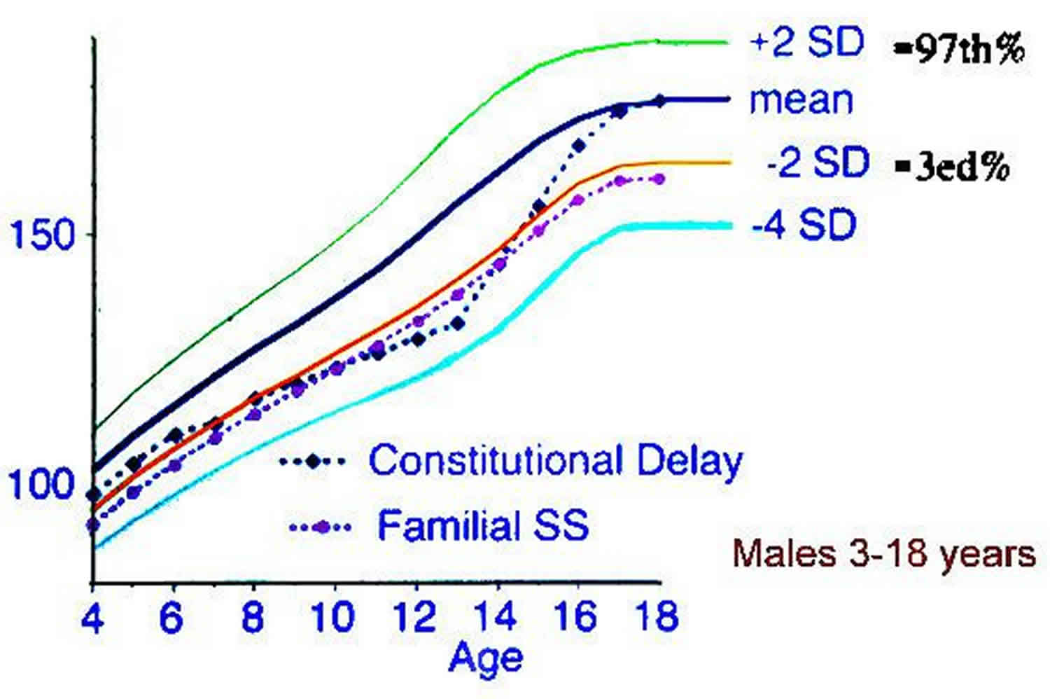 Short stature definition, causes, diagnosis & short stature treatment