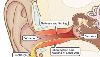 itchy inside ear