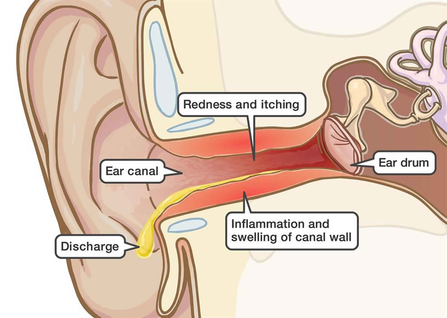Itchy Inside Ear, Itchy Painful Ear Causes  Treatment-9432