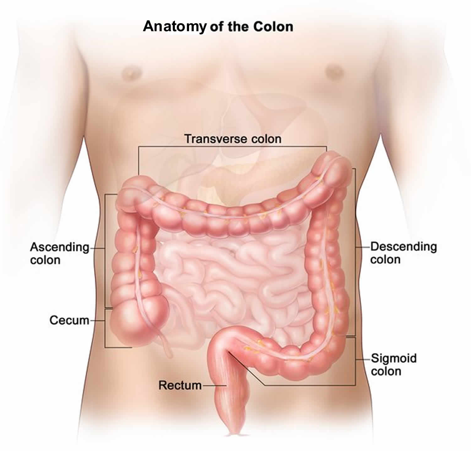 Average Cost Of Colon Resection Surgery