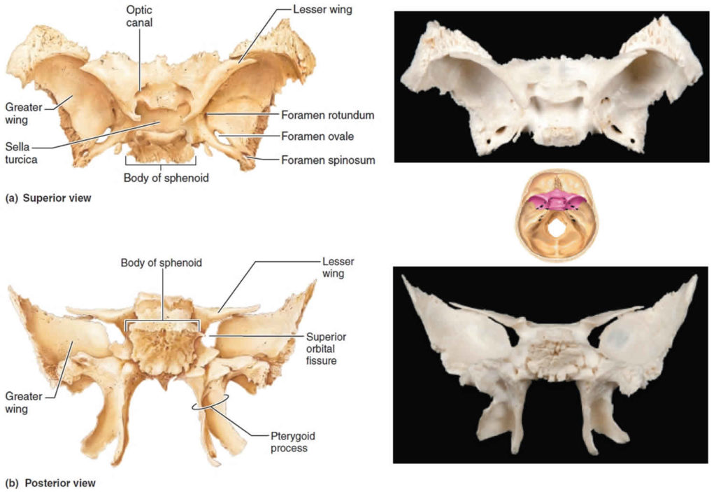 Sphenoid Bone Anatomy Function Parts Sphenoid Bone Fracture