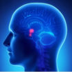 pituitary adenoma