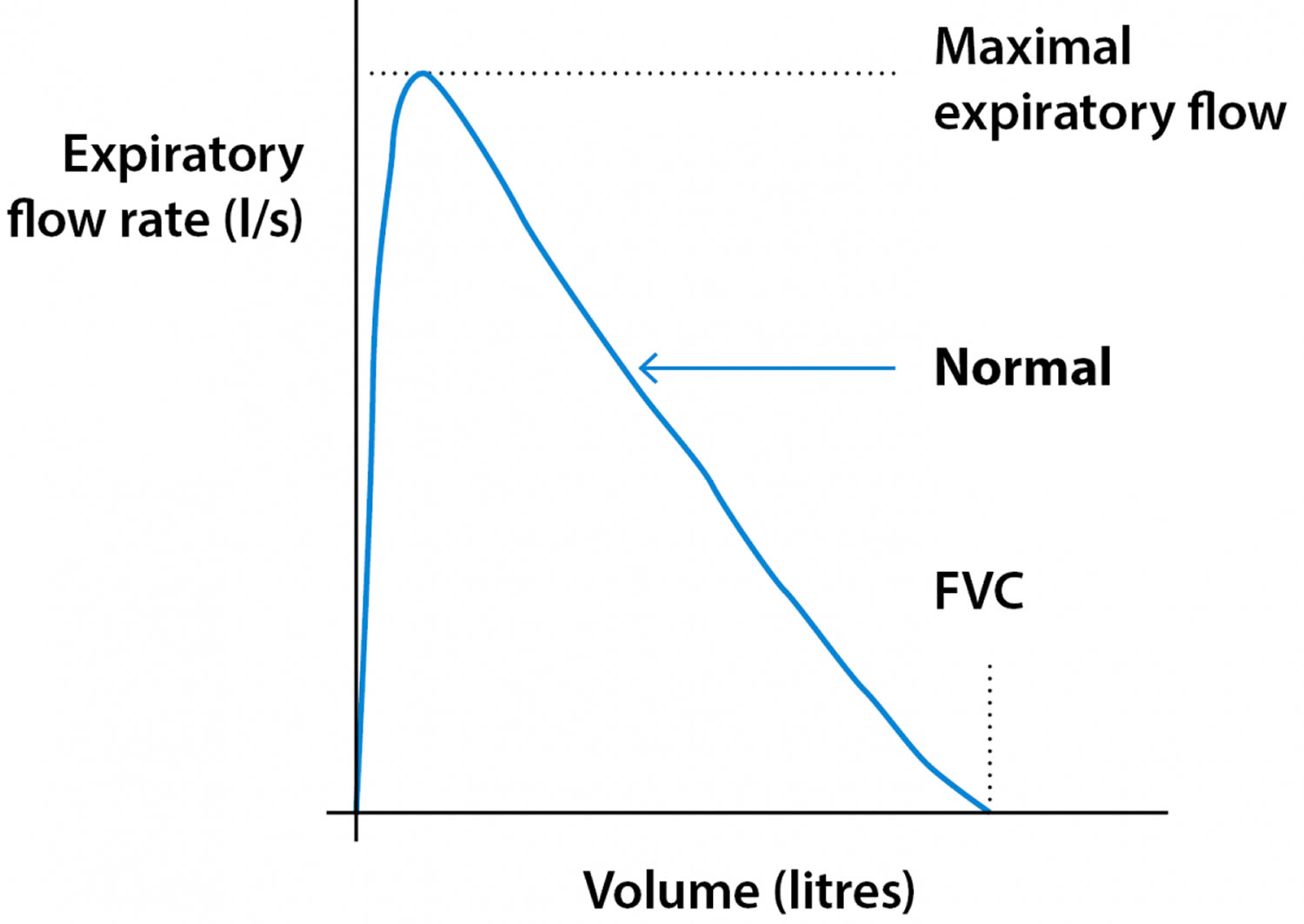 Spirometry normal pattern