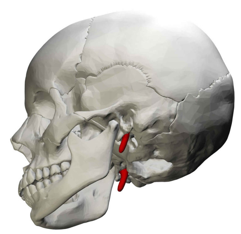 Eagle syndrome causes, symptoms, diagnosis, treatment & prognosis