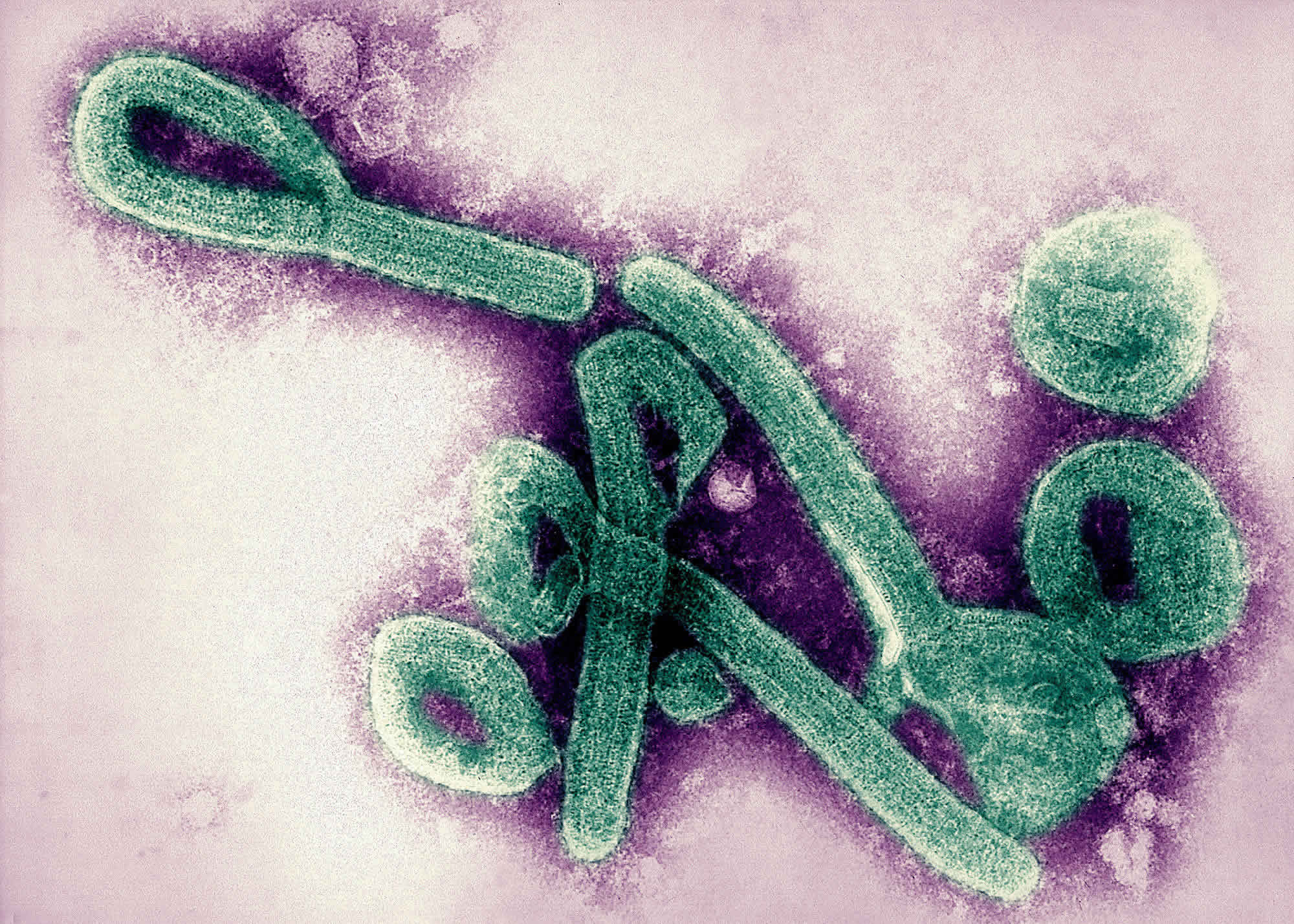 Marburg virus transmission, disease, symptoms, diagnosis ...