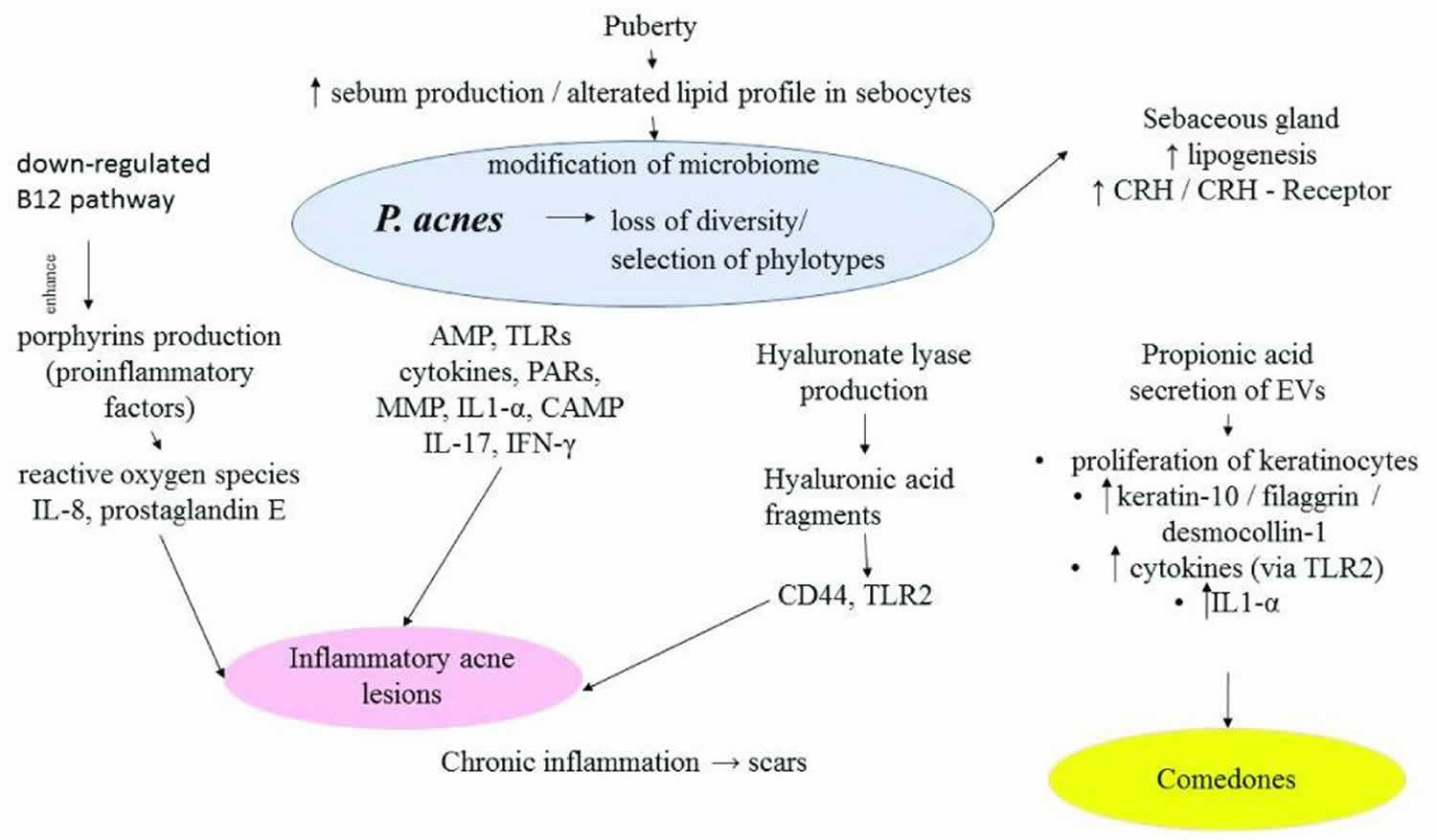 Propionibacterium acnes in acne