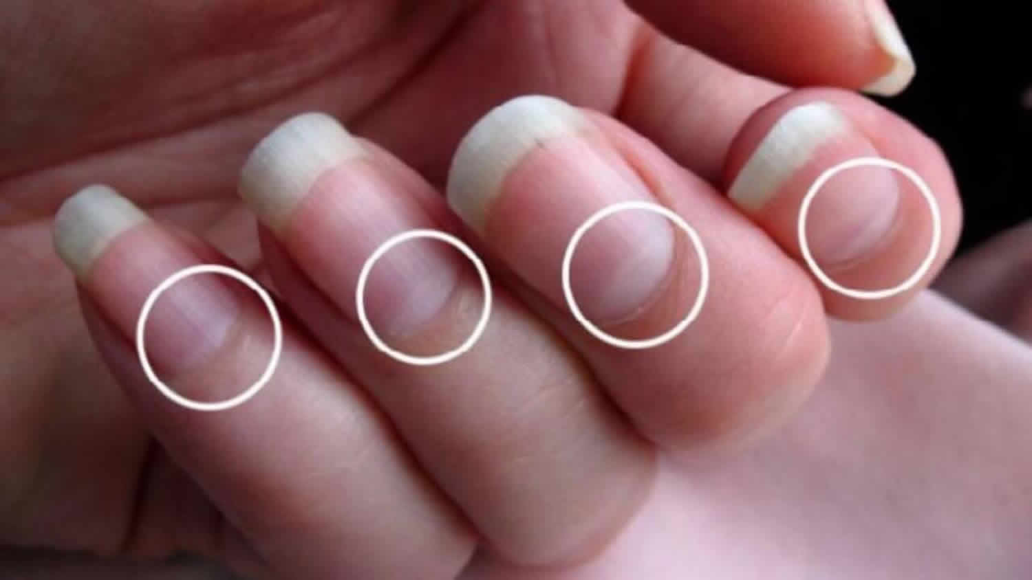 What Does The Lunula On Your Nails Mean