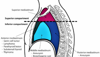 mediastinum