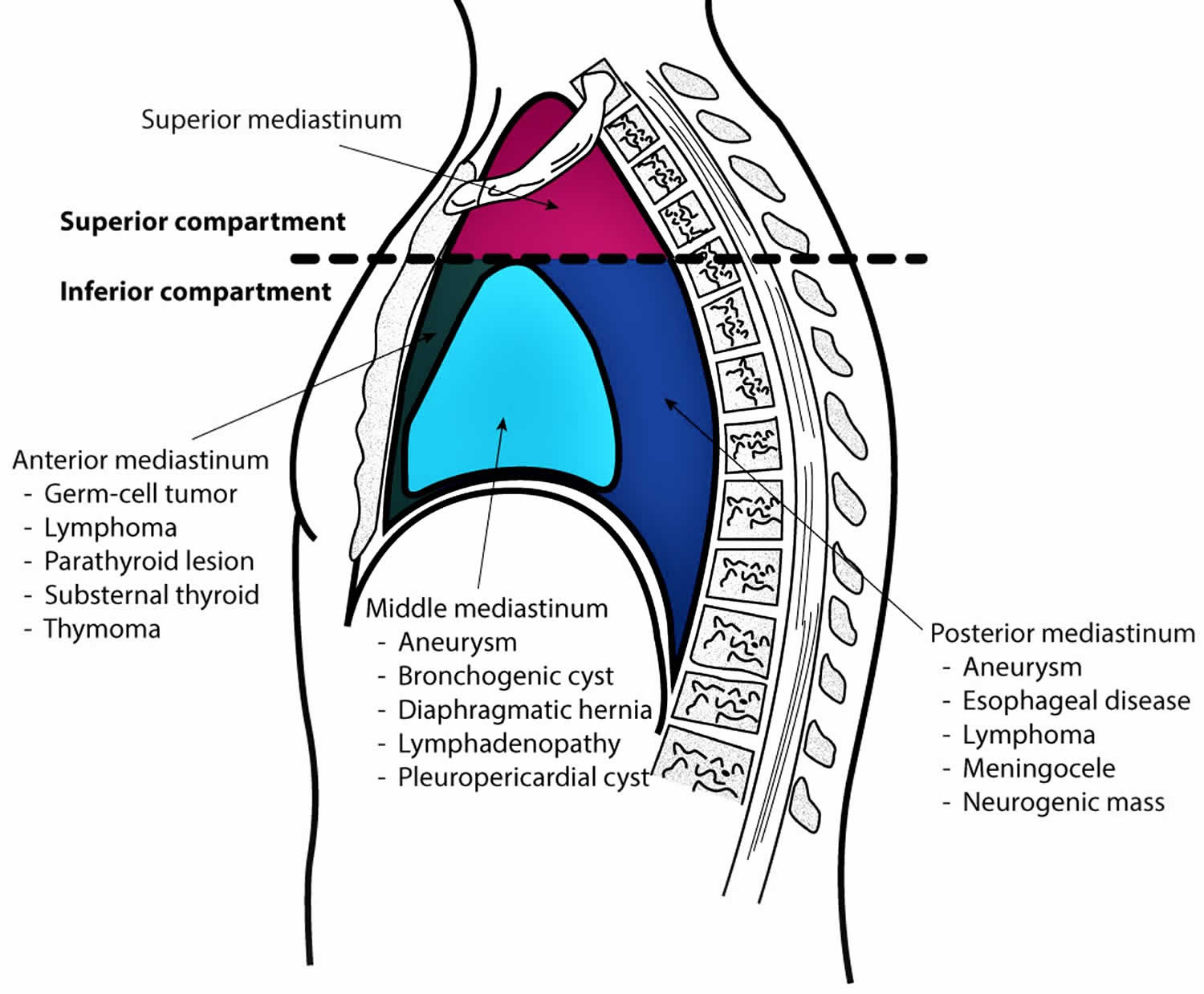 Where Is The Mediastinum Located