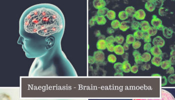 meningoencephalitis