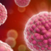 myeloproliferative disorder