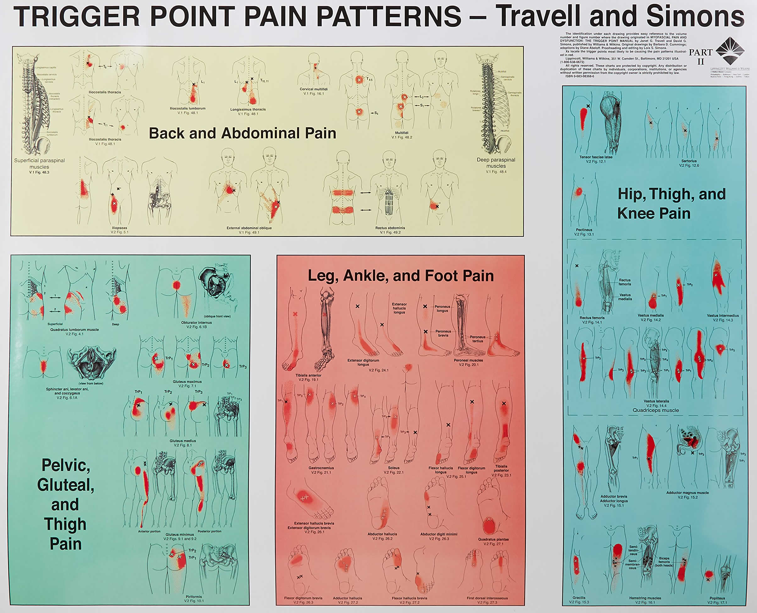 Myofascial Syndrome Trigger Points Chart