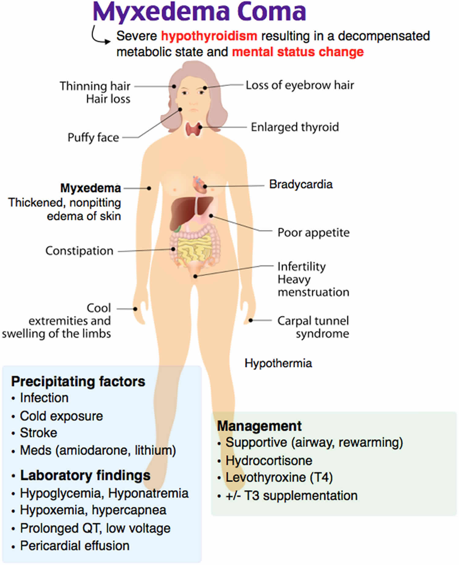 Myxedema Coma Causes Signs Symptoms Diagnosis Treatment Prognosis