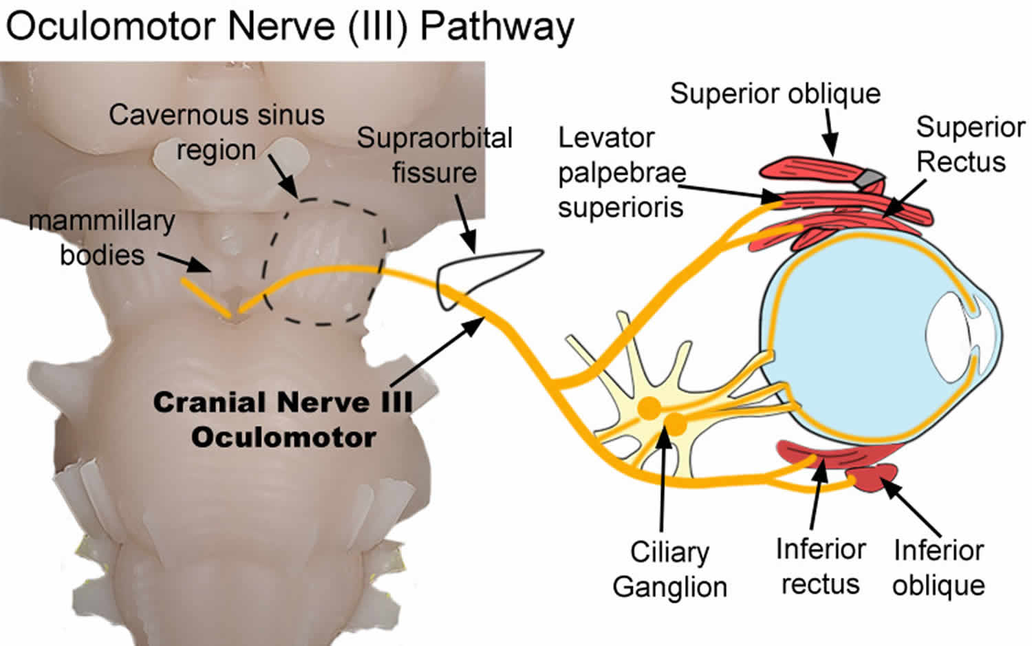 oculomotor-nerve-location-function-oculomotor-nerve-palsy-damage