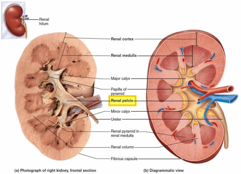 renal-pelvis-anatomy-function-blockage-cancer-stone