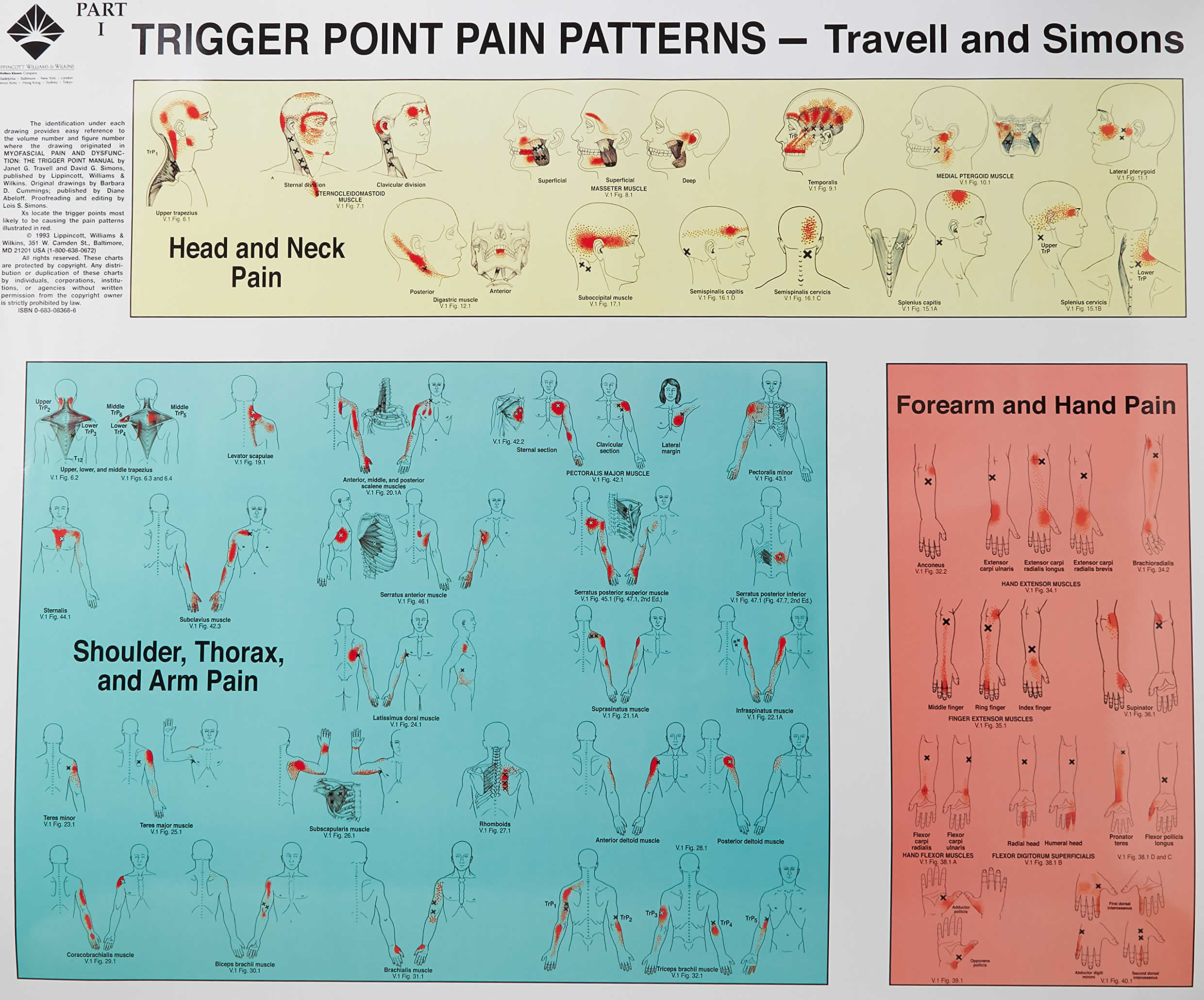 Trigger Point Dry Needling Diagram