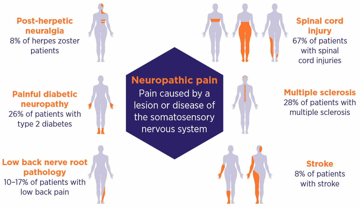 Neuropathic Pain A Roadmap For Diagnosis And Management Healthy Is Rich