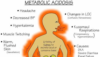 Hyperchloremic-acidosis