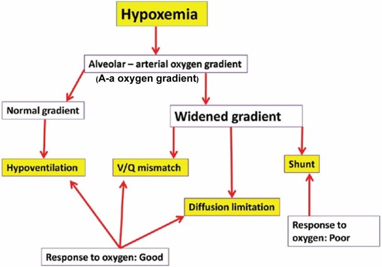 Hypoxemia definition, symptoms, diagnosis, treatment & prognosis