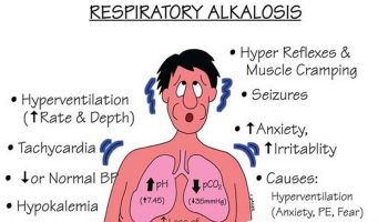 Respiratory alkalosis