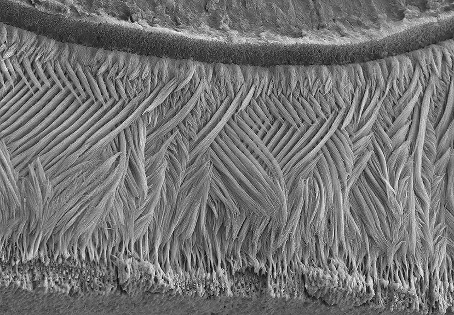 Tooth enamel electron microscopy