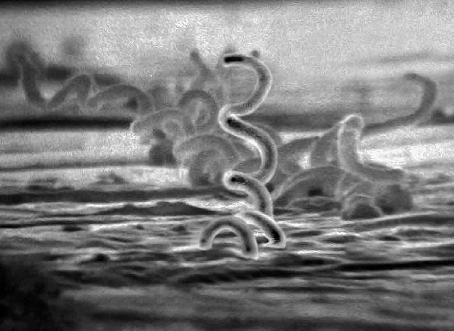 Treponema pallidum bacteria