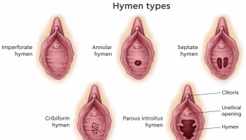 hymen-types