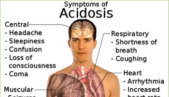 metabolic acidosis