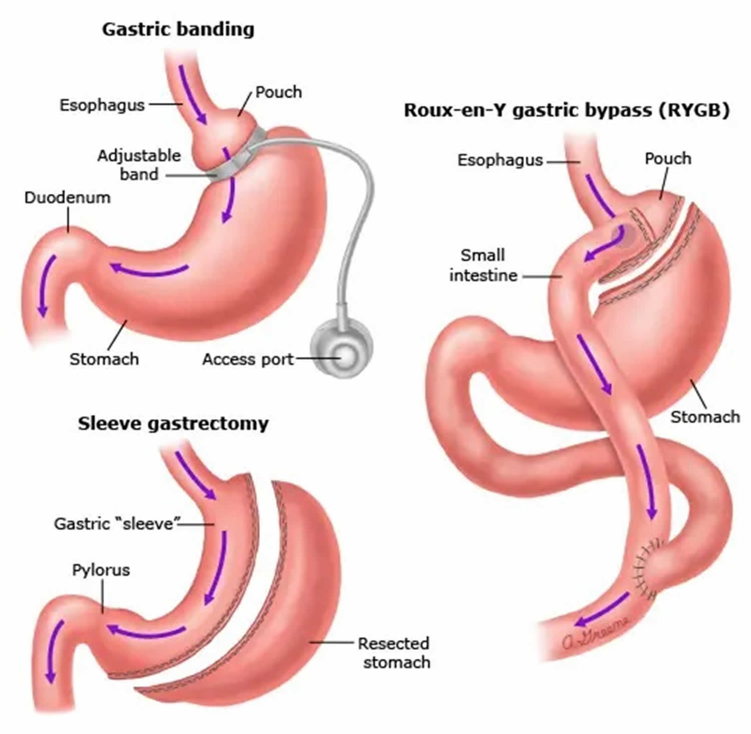 Does Weight Loss Affect Nose